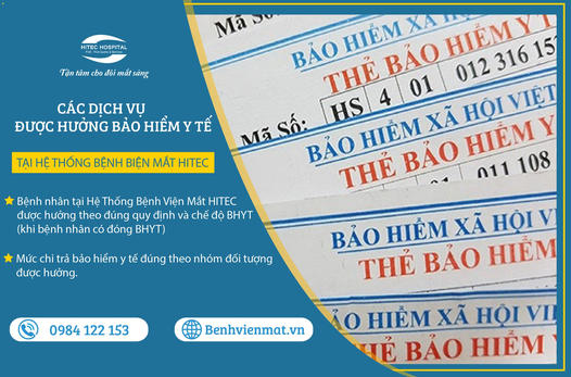 he-thong-benh-vien-mat-hitec-thong-tuyen-bao-hiem-y-te