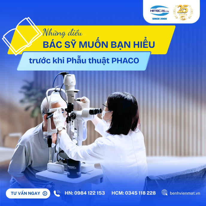 nhung-dieu-can-biet-truoc-khi-phau-thuat-phaco-cuom-kho