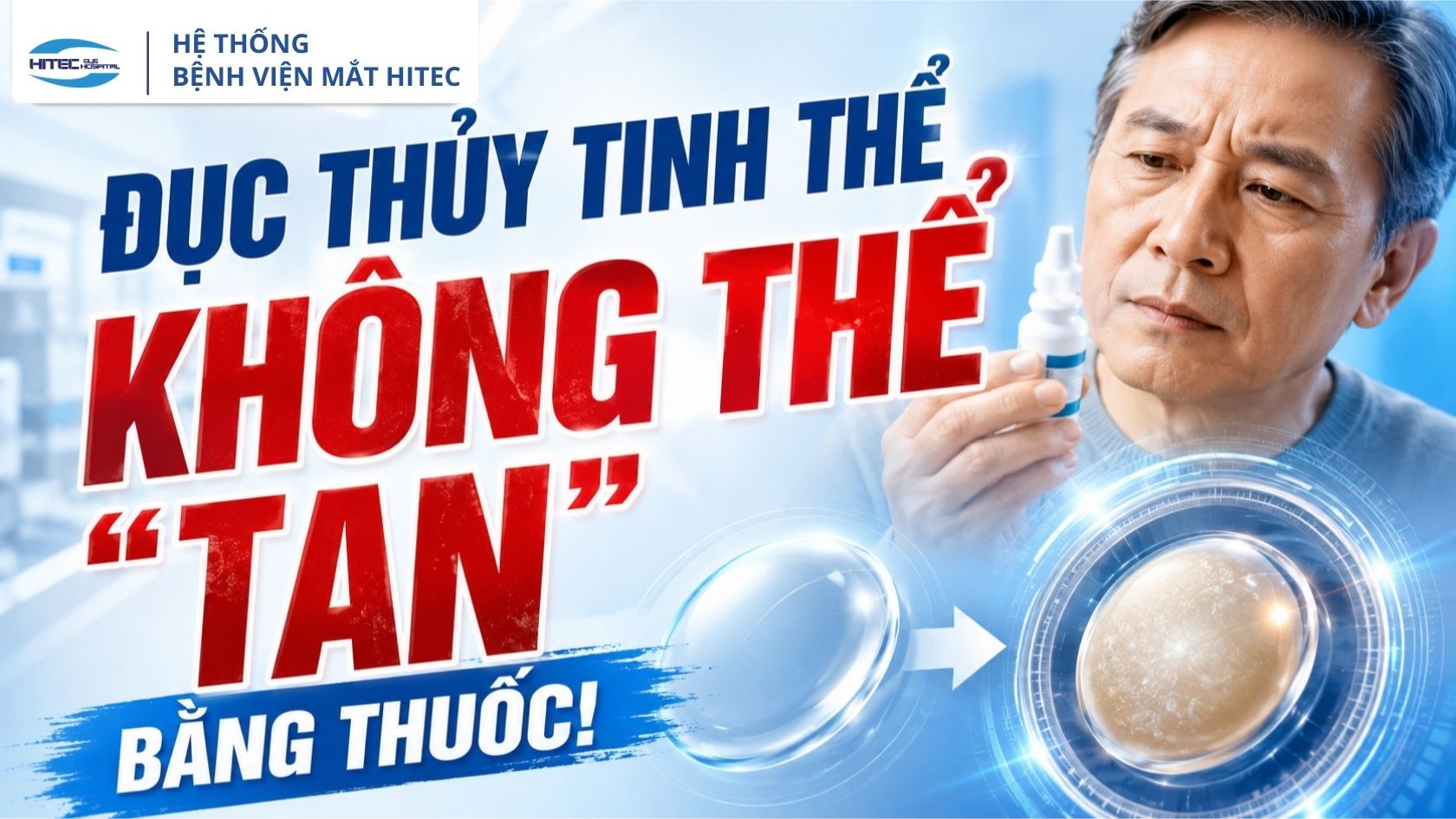 co-the-chua-duc-thuy-tinh-the-ma-khong-can-phau-thuat