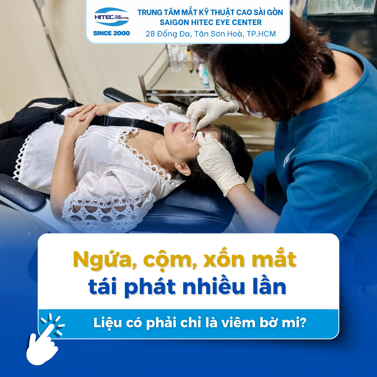 ngua-com-xon-mat-tai-phat-nhieu-lan lieu-co-phai-chi-la-viem-bo-mi